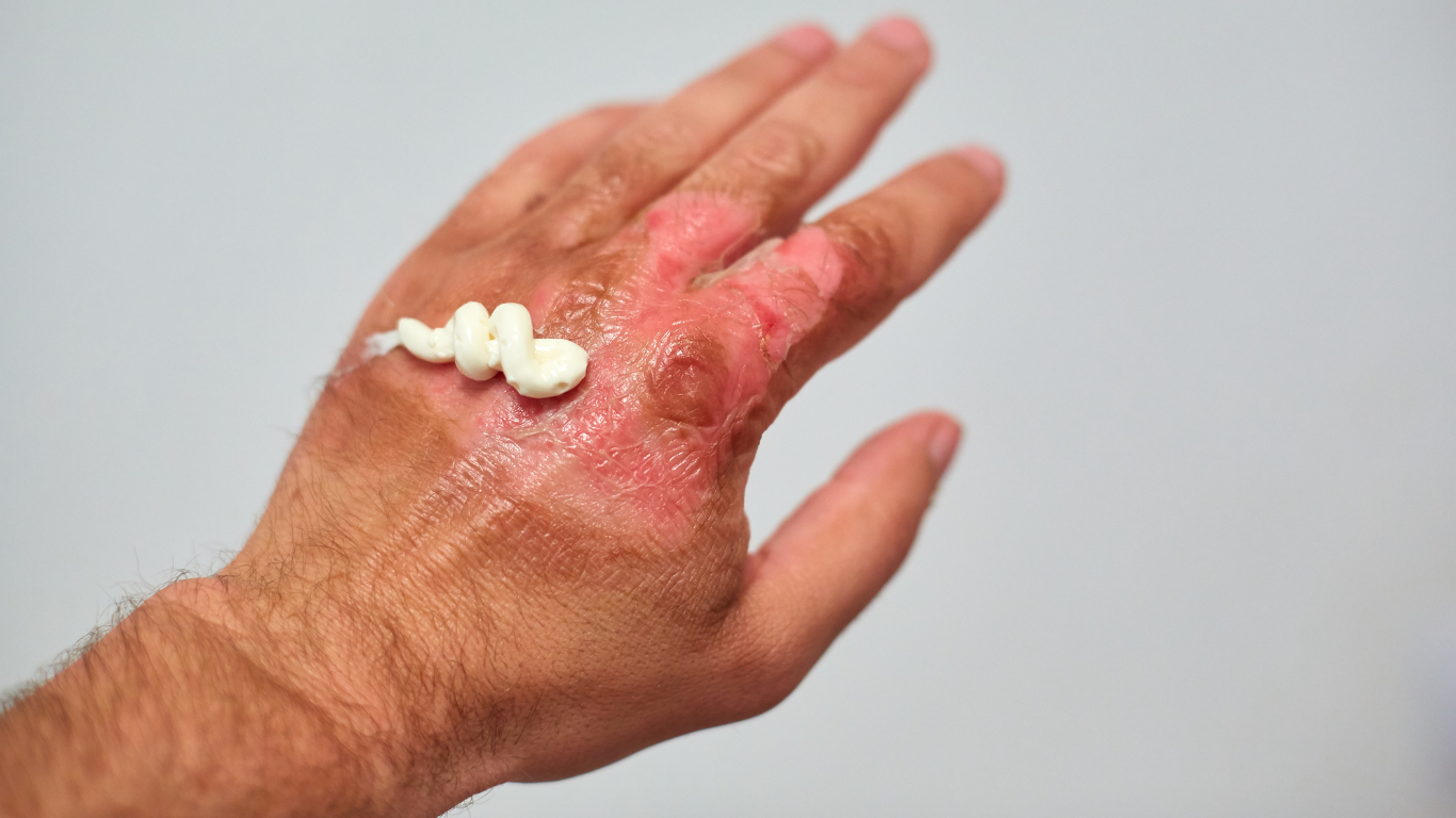🩹 Guía Completa sobre el Cuidado de la Piel y Manejo de Heridas
